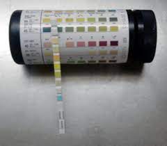 Where To Buy Urine Test Stripes In South Africa - 2024/2025